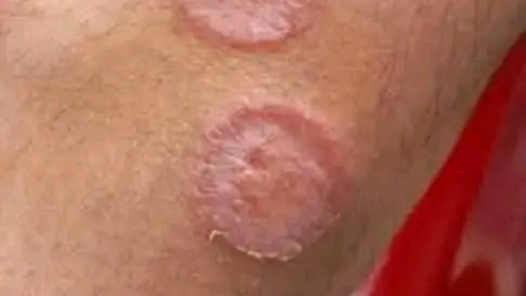 Estos son los signos de que está creciendo en tu estómago células cancerígenas uno de las ma frecuentes y peores enfermedades en la actualidad …Ver más