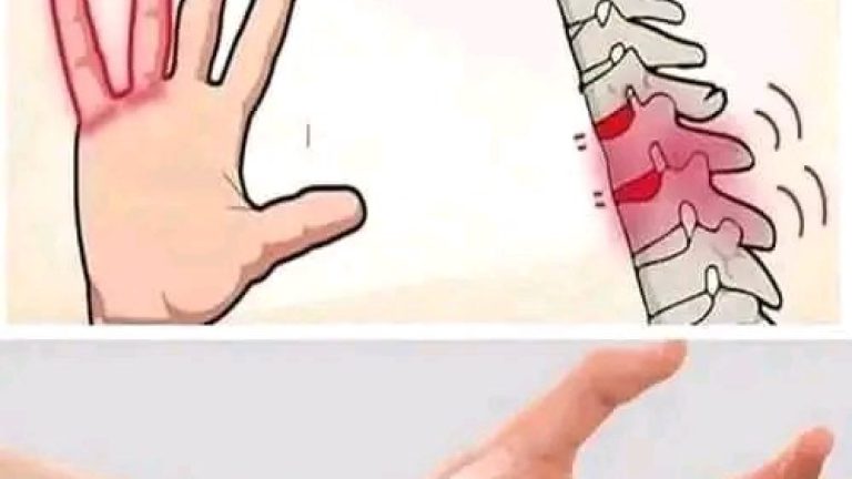 Si se te DUERMEN LAS MANOS es una clara SEÑAL que TIENES está enfermedad y ni siquiera lo sabías …Ver más