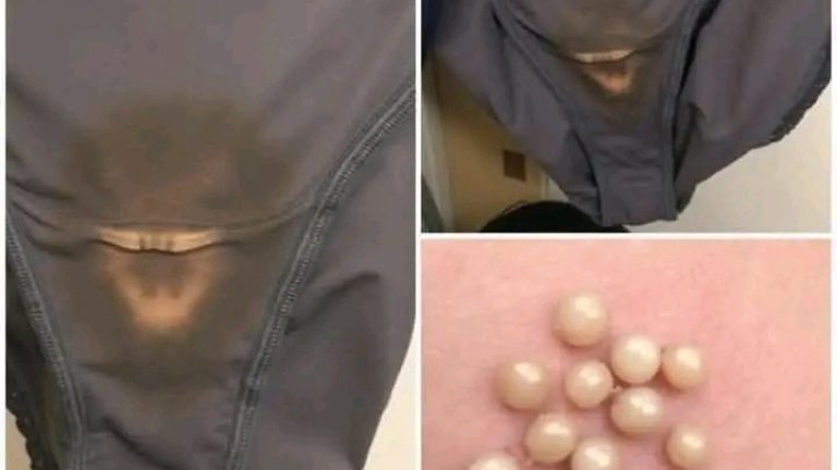 CUIDADO, si notas esto en tu ropa interior y el olor es algo desagradable deberías saber que  significa que tienes Cave…ver más