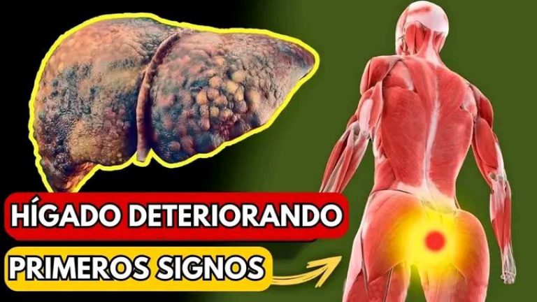 12 Señales que anuncian que tu hígado se está deteriorando