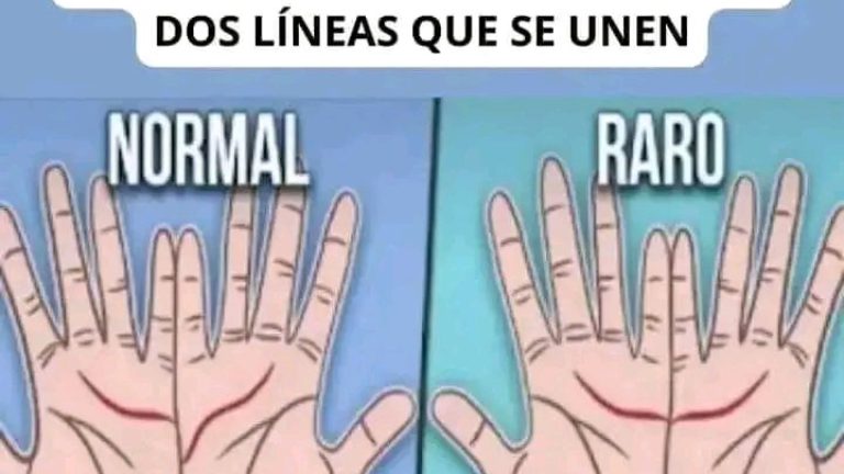 Si estas líneas de tu mano se juntan significa que ocurren cosas en tu cuerpo