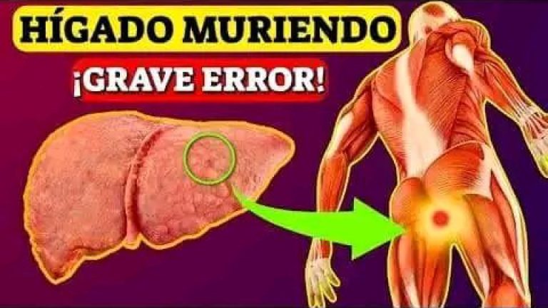 Señales Extrañas de que ya tienes DAÑO HEPÁTICO