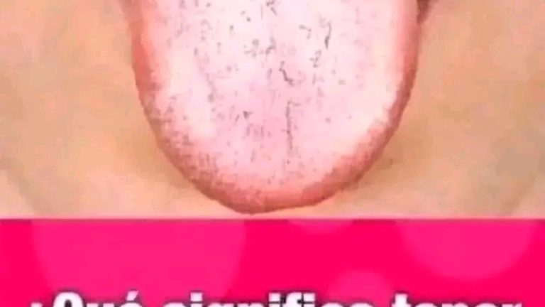ATENCIÓN. Si tienes la lengua blanca y pastosa significas qué tines daño en el hígado.