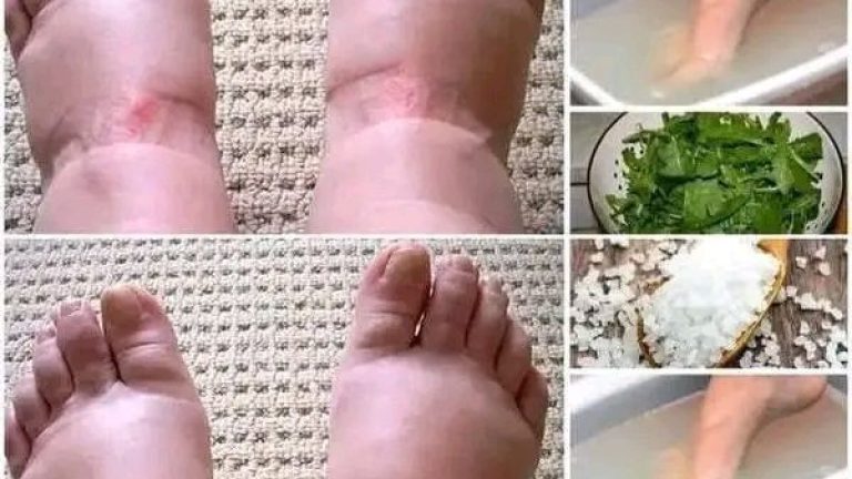 ATENCIÓN! CON LOS PIES HINCHADOS PUEDES ESTAR…𝗩𝗲𝗿 𝗺𝗮𝘀