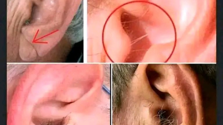 SABIAS QUE si te crecen pelos en las orejas es porque tu cuerpo tien …ver más