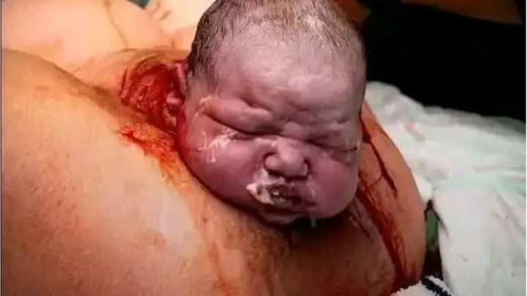 Madre da a luz en pleno…Ver más