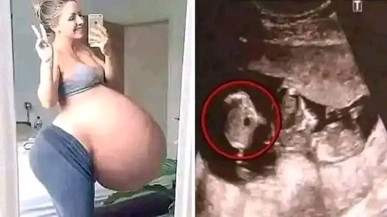Fue a dar a luz al hospital y sacar…Ver más