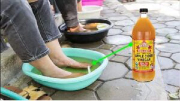 Sabías que si sumerges tus pies en vinagre, aunque sea una vez por semana, puede pasar esto en tu cuerpo