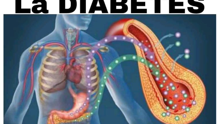 Diabetes: 7 remedios caseros para tratarla de manera natural