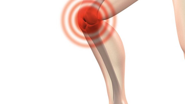 FORTALECER TUS RODILLA, CARTILAGO  Y LIGAMENTO