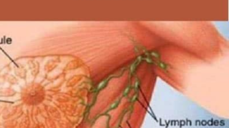 CIENTÍFICOS DESCUBREN QUE CAUSA EL CÁNCER DE MAMA Y LO BEBES A DIARIO